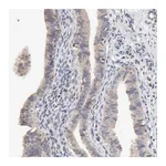 Atlas Antibodies Anti-ZNF157 Antibody