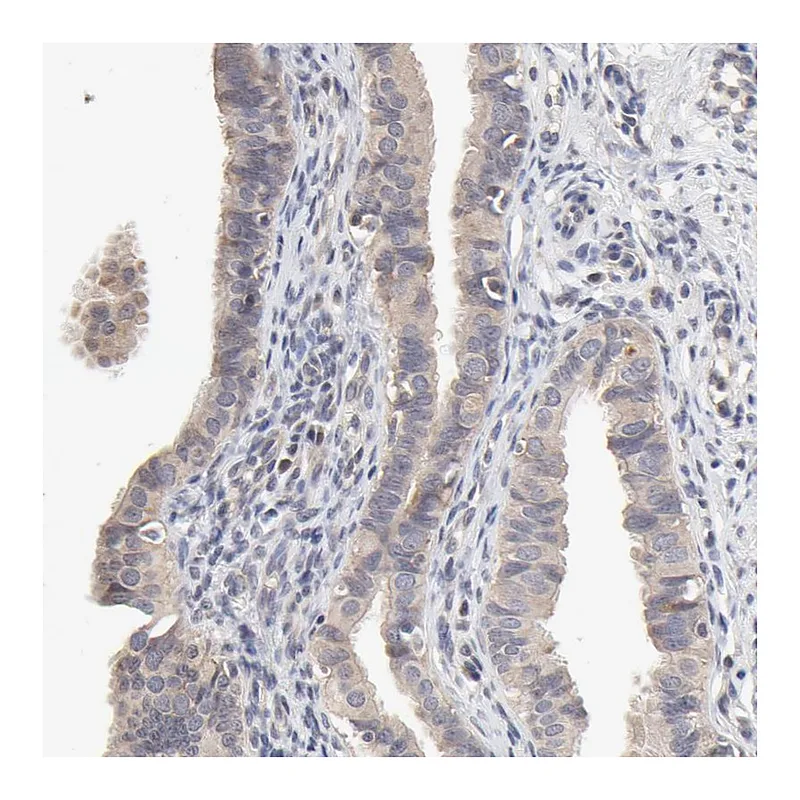 Atlas Antibodies Anti-ZNF157 Antibody