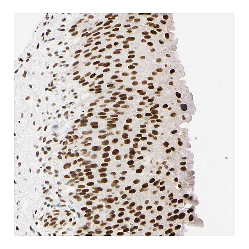 Atlas Antibodies Anti-ZNF134 Antibody