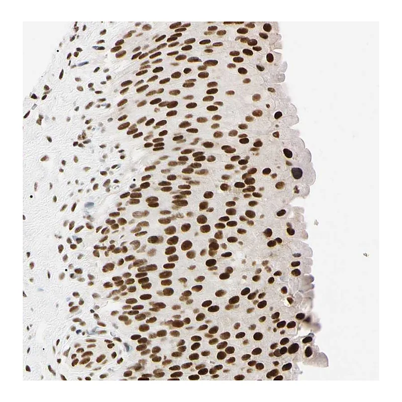 Atlas Antibodies Anti-ZNF134 Antibody