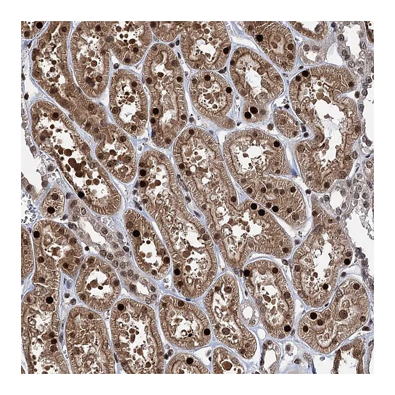 Atlas Antibodies Anti-ZNF169 Antibody