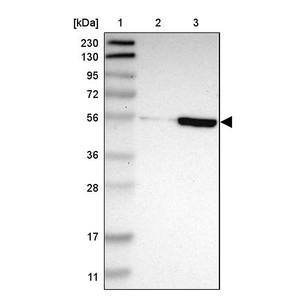 Atlas Antibodies Anti-ZNF165 Antibody