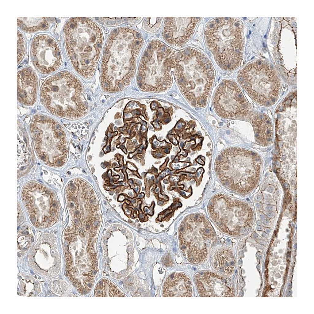 Atlas Antibodies Anti-ZNF16 Antibody