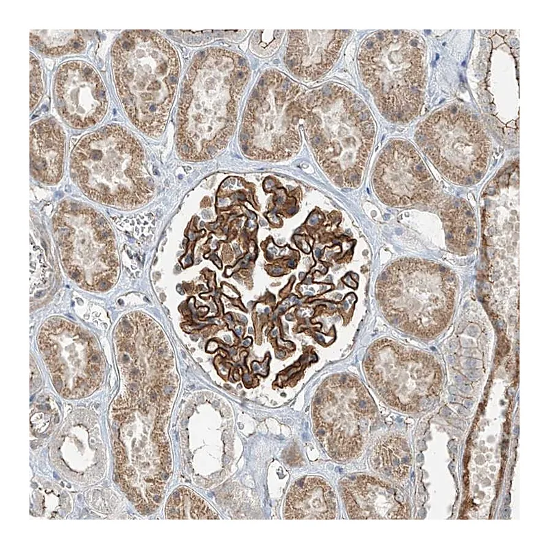 Atlas Antibodies Anti-ZNF16 Antibody