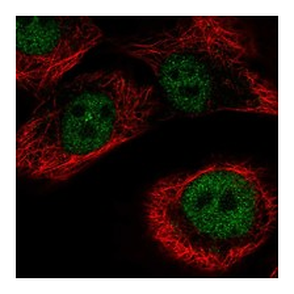 Atlas Antibodies Anti-ZNF169 Antibody