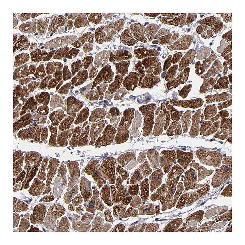 Atlas Antibodies Anti-ZNF175 Antibody
