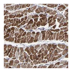 Atlas Antibodies Anti-ZNF175 Antibody