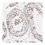 Atlas Antibodies Anti-ZNF177 Antibody