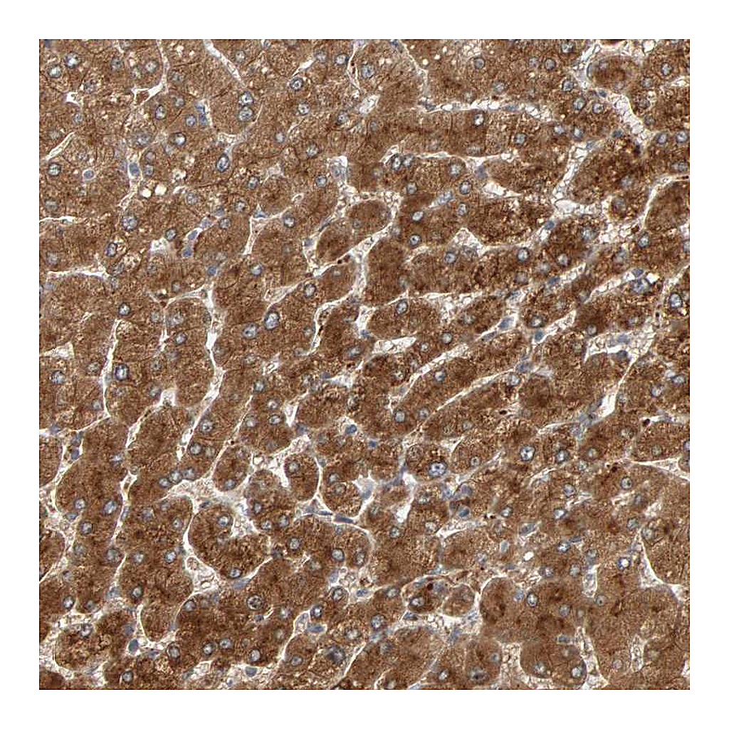 Atlas Antibodies Anti-ZNF160 Antibody