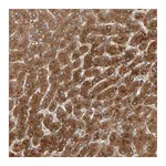 Atlas Antibodies Anti-ZNF160 Antibody