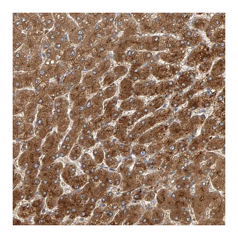 Atlas Antibodies Anti-ZNF160 Antibody