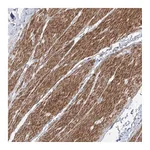 Atlas Antibodies Anti-ZNF180 Antibody
