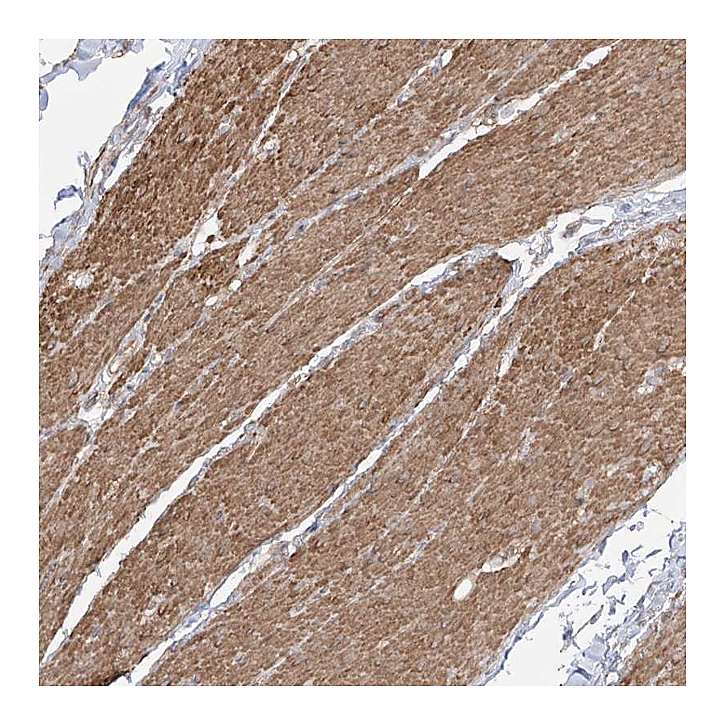 Atlas Antibodies Anti-ZNF180 Antibody