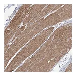 Atlas Antibodies Anti-ZNF180 Antibody