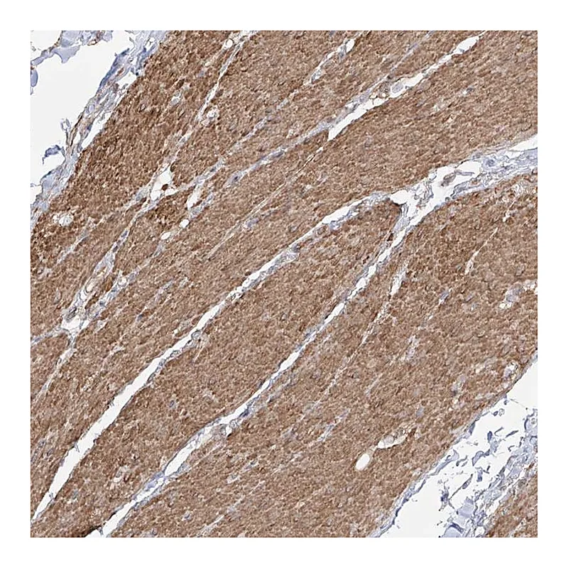 Atlas Antibodies Anti-ZNF180 Antibody