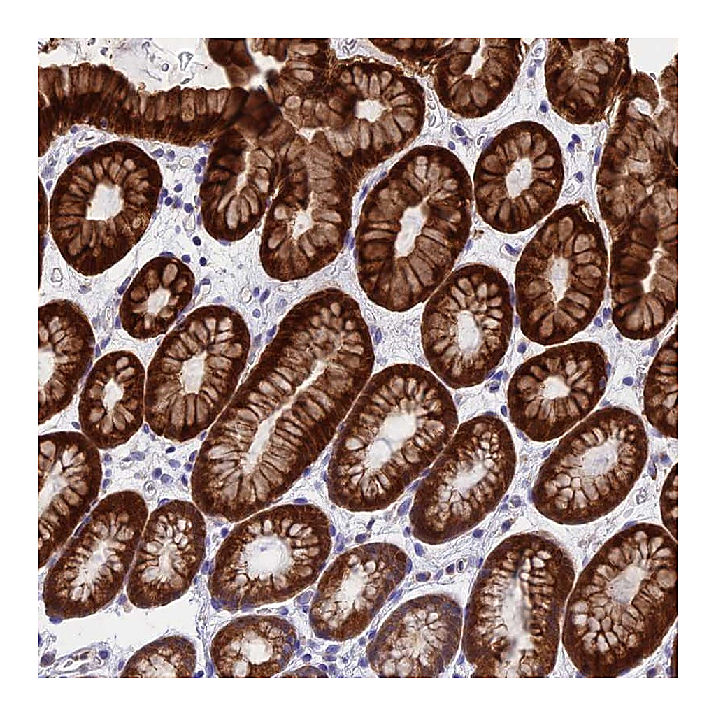 Atlas Antibodies Anti-ZNF181 Antibody