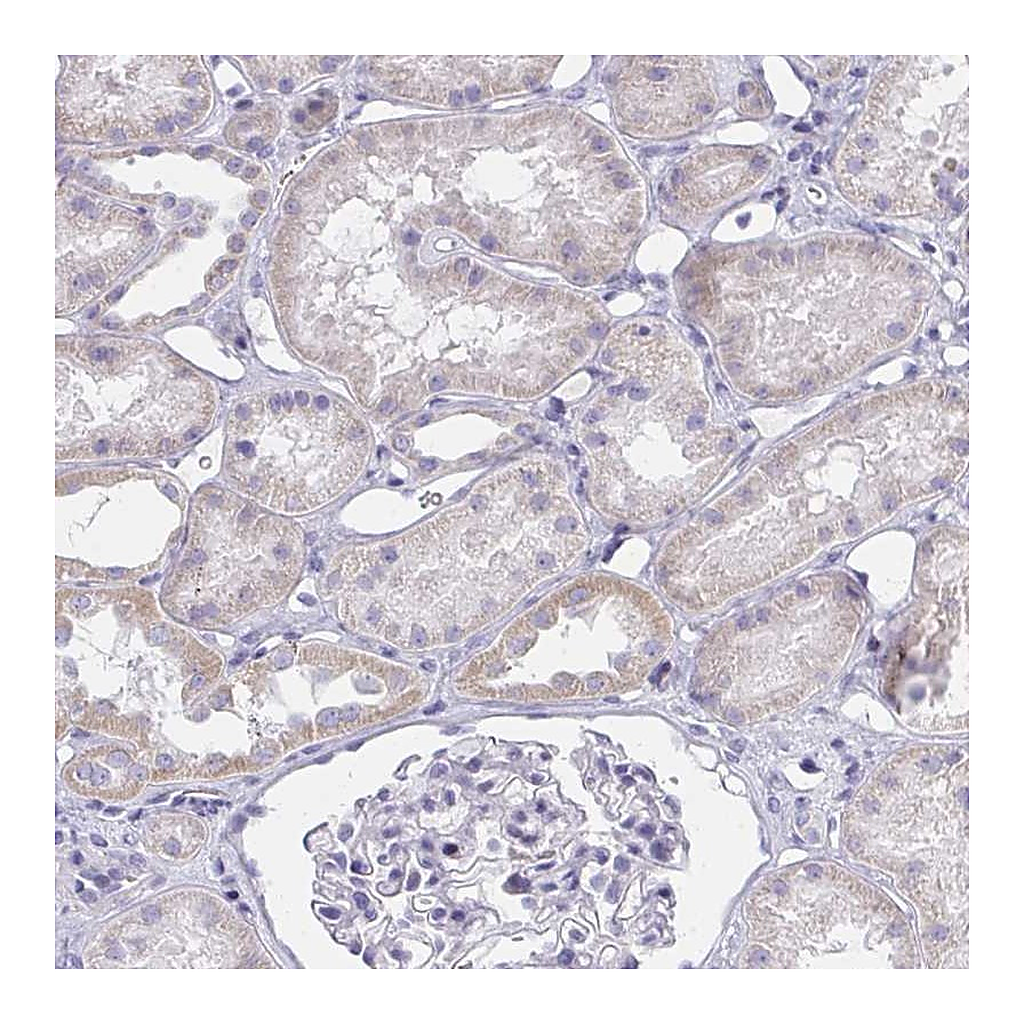 Atlas Antibodies Anti-ZNF182 Antibody