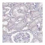 Atlas Antibodies Anti-ZNF182 Antibody