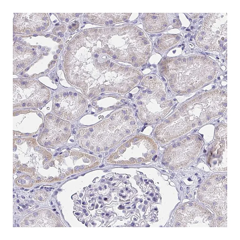 Atlas Antibodies Anti-ZNF182 Antibody