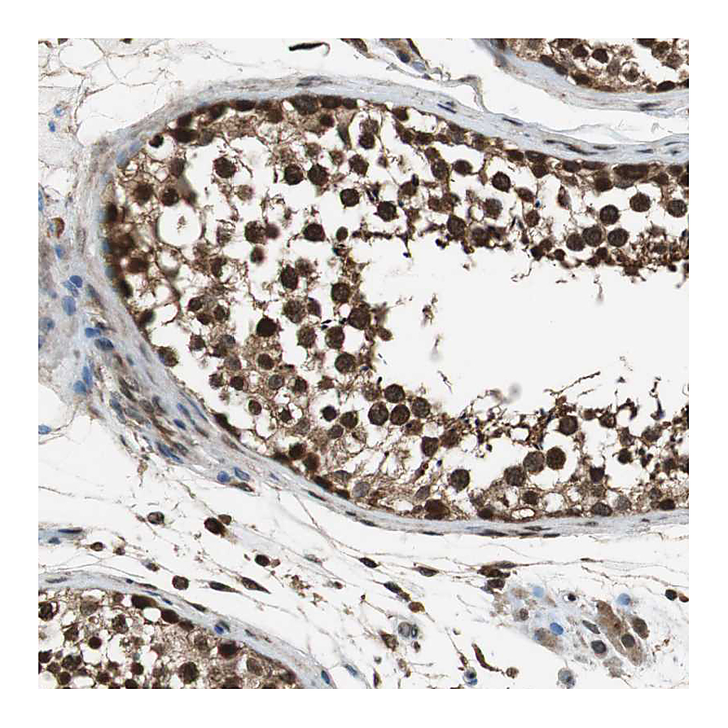 Atlas Antibodies Anti-ZNF18 Antibody