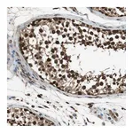 Atlas Antibodies Anti-ZNF18 Antibody