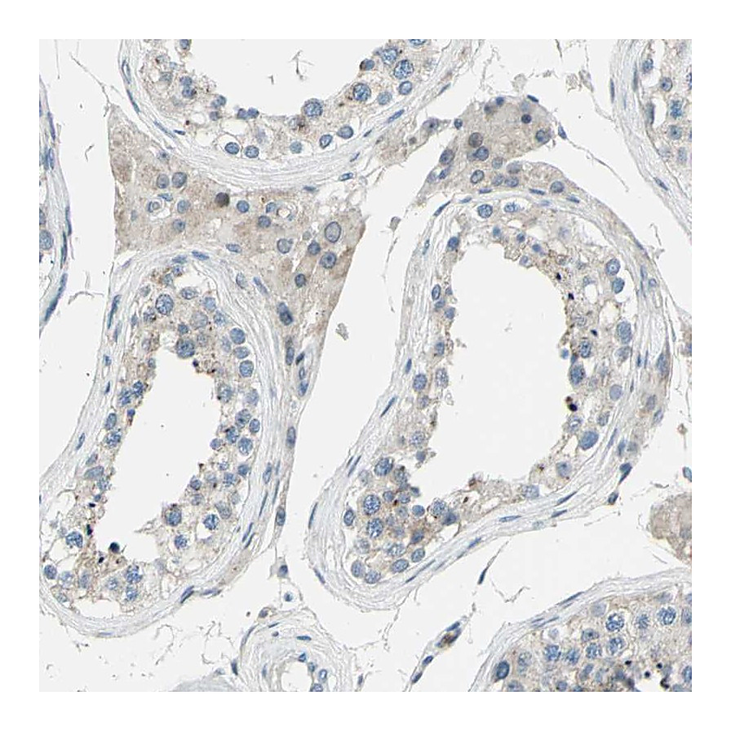 Atlas Antibodies Anti-ZNF184 Antibody