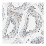 Atlas Antibodies Anti-ZNF184 Antibody