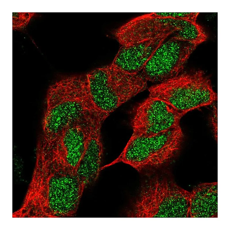 Atlas Antibodies Anti-ZNF184 Antibody