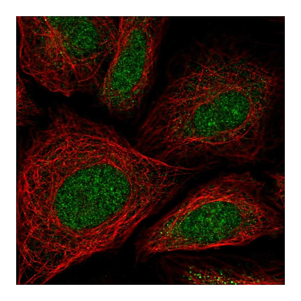 Atlas Antibodies Anti-ZNF181 Antibody
