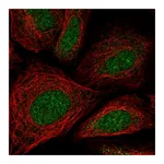 Atlas Antibodies Anti-ZNF181 Antibody