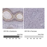 Atlas Antibodies Anti-ZNF185 Antibody
