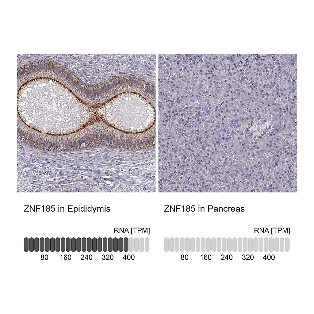 Atlas Antibodies Anti-ZNF185 Antibody
