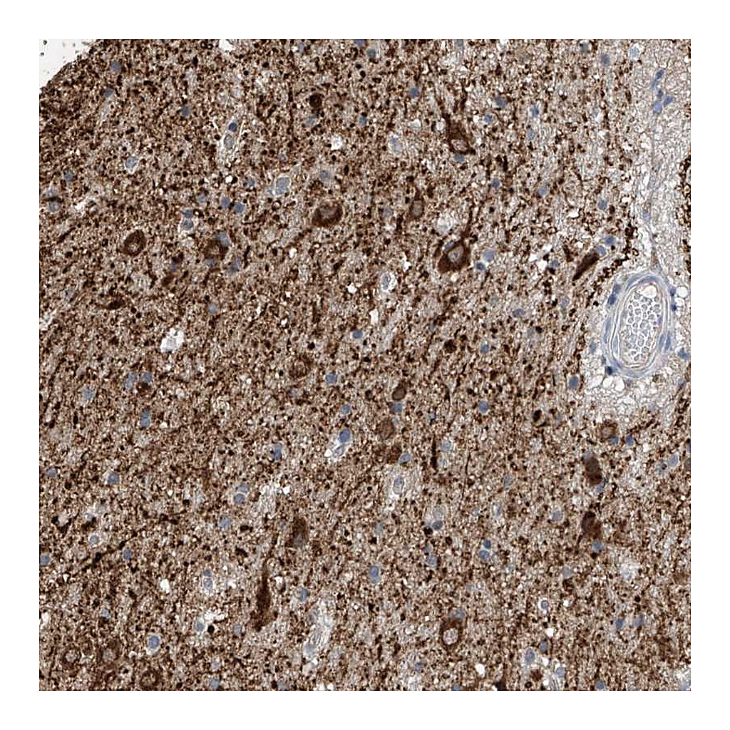 Atlas Antibodies Anti-ZNF189 Antibody