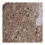 Atlas Antibodies Anti-ZNF189 Antibody