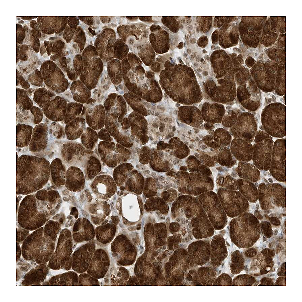 Atlas Antibodies Anti-ZNF195 Antibody