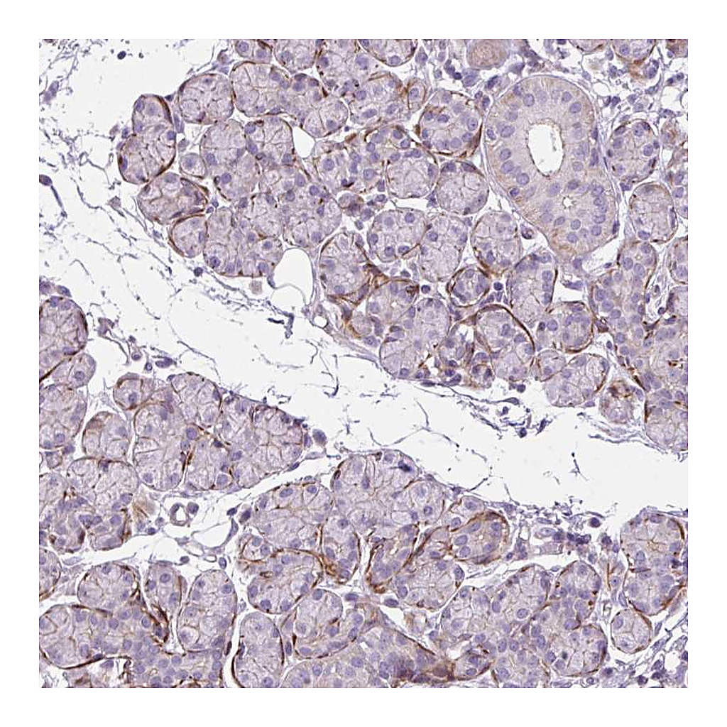 Atlas Antibodies Anti-ZNF197 Antibody