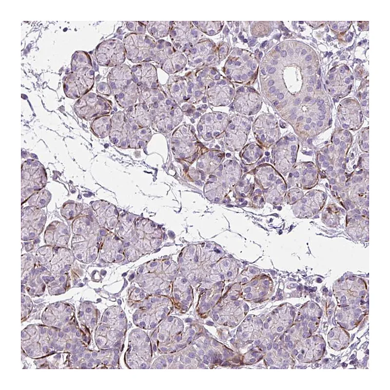 Atlas Antibodies Anti-ZNF197 Antibody