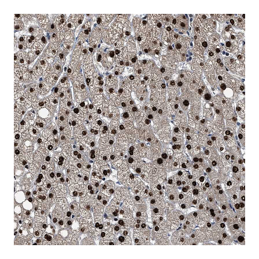 Atlas Antibodies Anti-ZNF20 Antibody