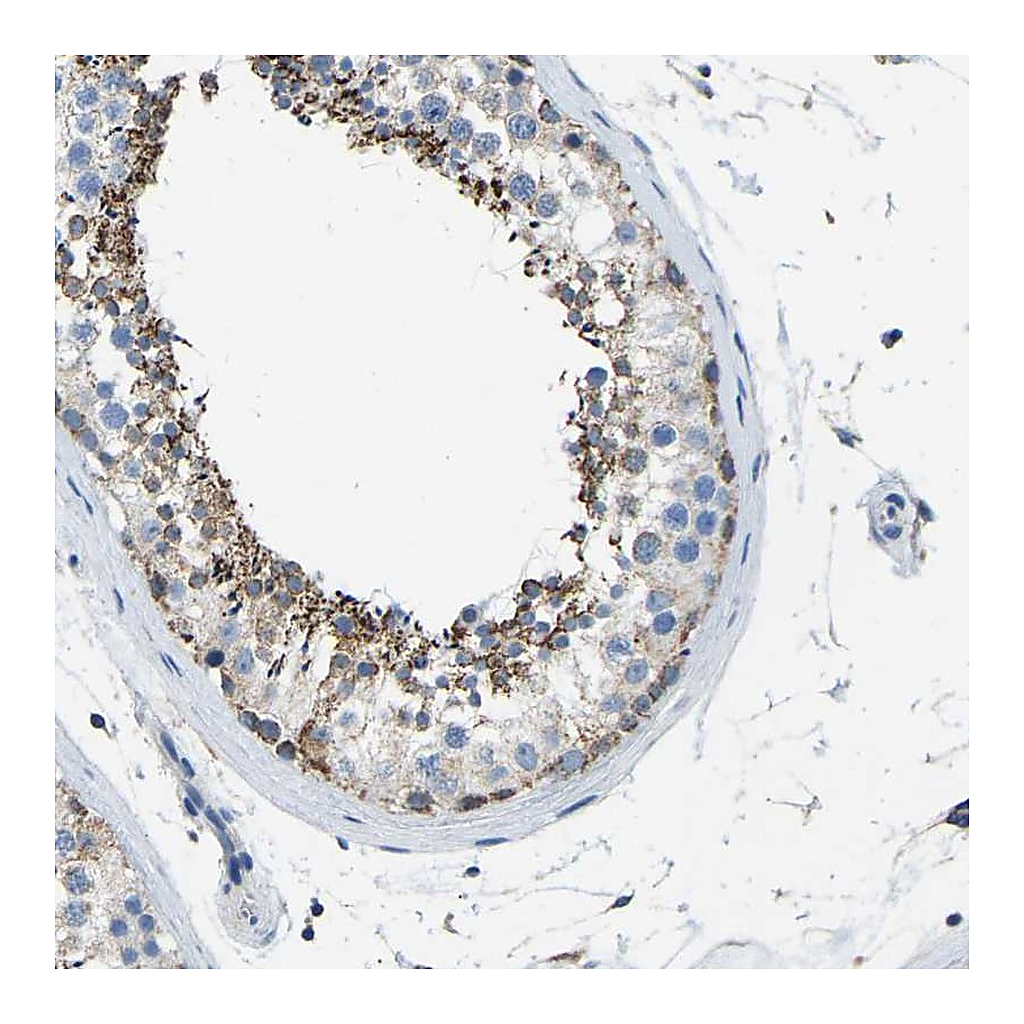 Atlas Antibodies Anti-ZNF200 Antibody