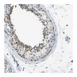 Atlas Antibodies Anti-ZNF200 Antibody