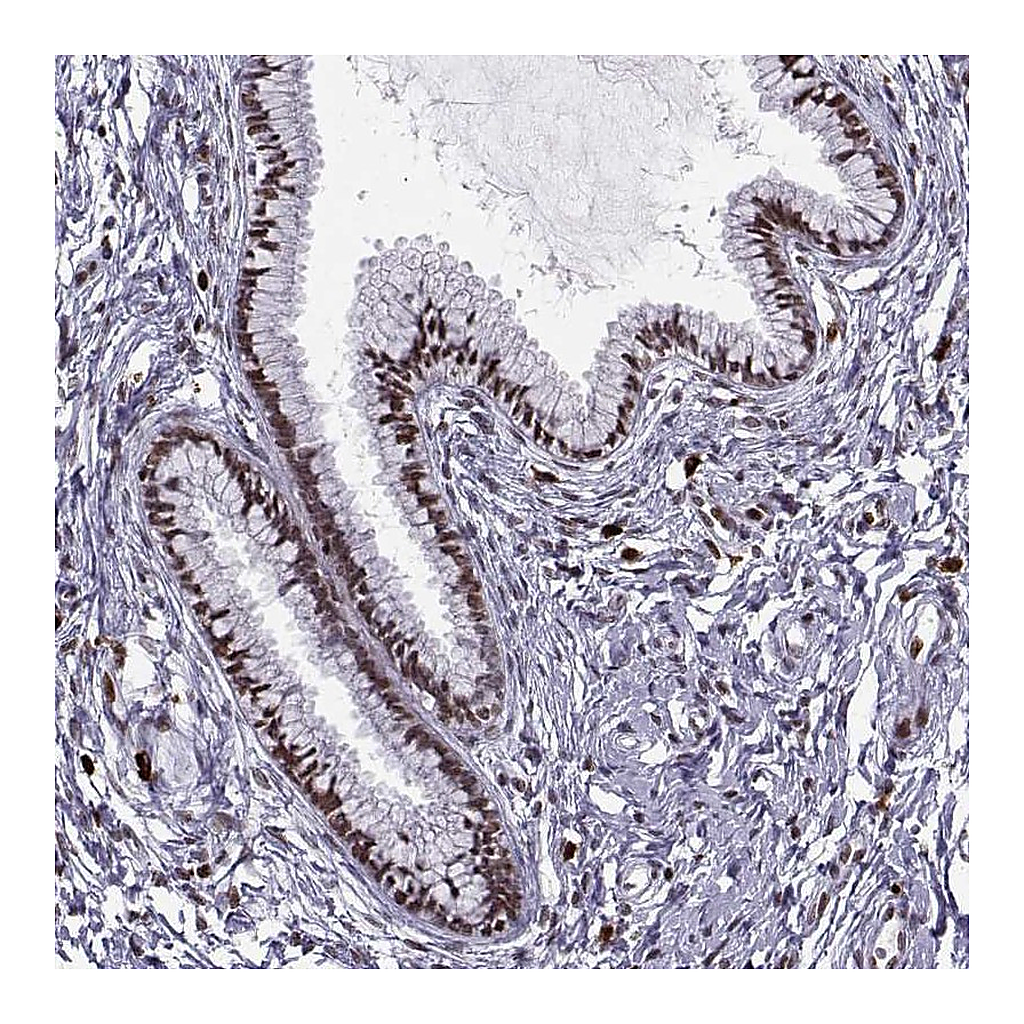 Atlas Antibodies Anti-ZNF19 Antibody