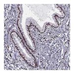 Atlas Antibodies Anti-ZNF19 Antibody