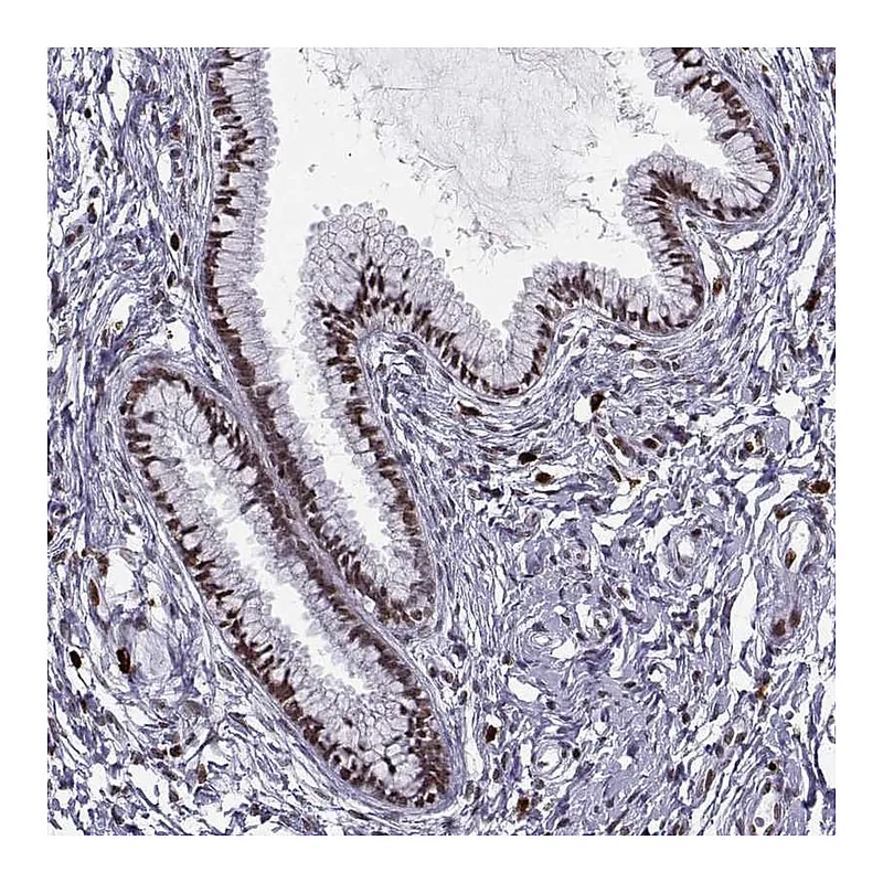 Atlas Antibodies Anti-ZNF19 Antibody