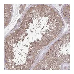 Atlas Antibodies Anti-ZNF200 Antibody