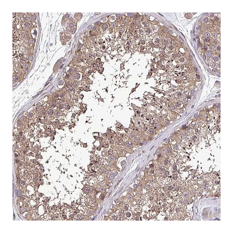 Atlas Antibodies Anti-ZNF200 Antibody