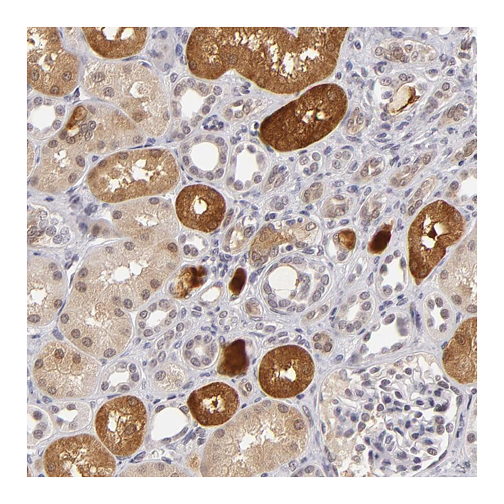 Atlas Antibodies Anti-ZNF205 Antibody