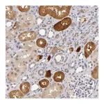Atlas Antibodies Anti-ZNF205 Antibody