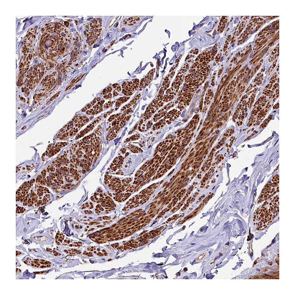 Atlas Antibodies Anti-ZNF2 Antibody