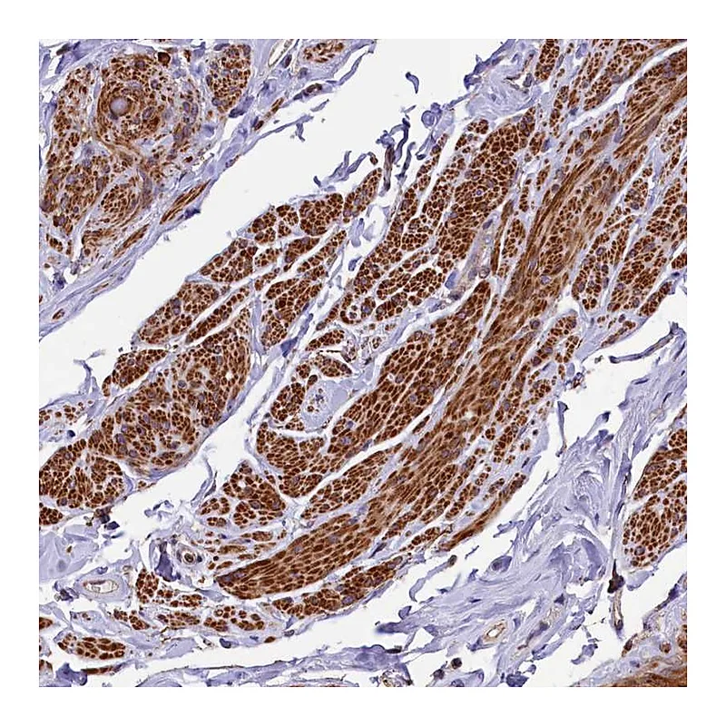Atlas Antibodies Anti-ZNF2 Antibody
