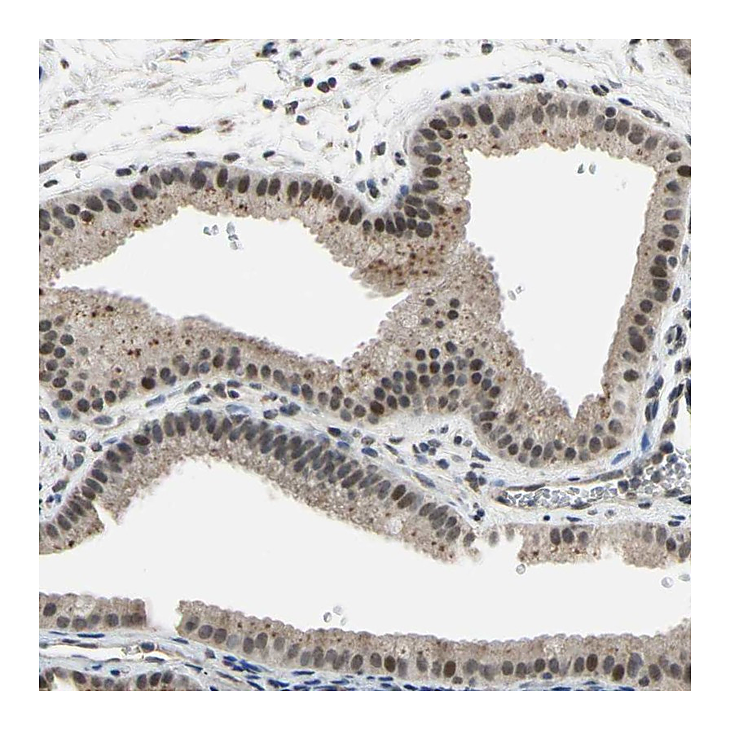 Atlas Antibodies Anti-ZNF174 Antibody